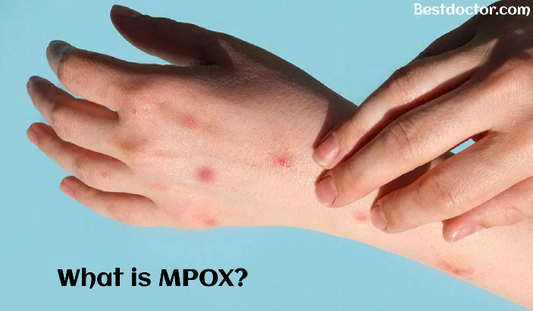 Understanding Mpox: A Comprehensive Overview